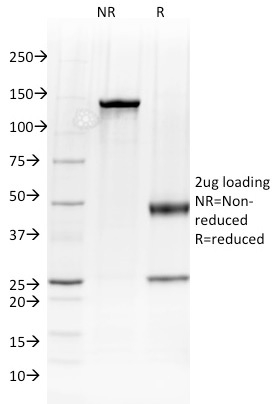Data from SDS-PAGE analysis of Anti-Albumin antibody (Clone ALB/2144). Reducing lane (R) shows heavy and light chain fragments. NR lane shows intact antibody with expected MW of approximately 150 kDa. The data are consistent with a high purity, intact mAb.